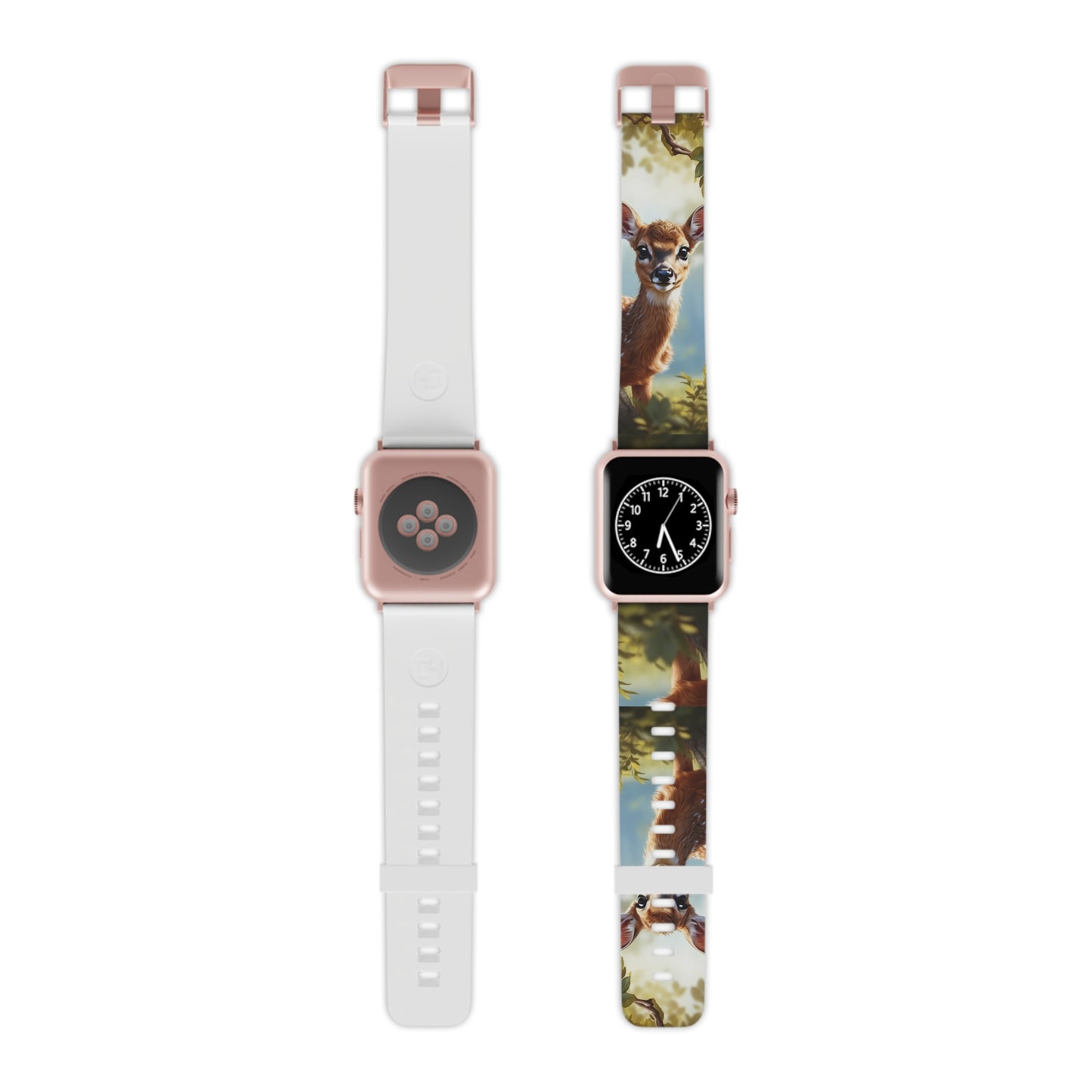 Whimsical Fawn in a Sunlit Forest Apple Watch Band