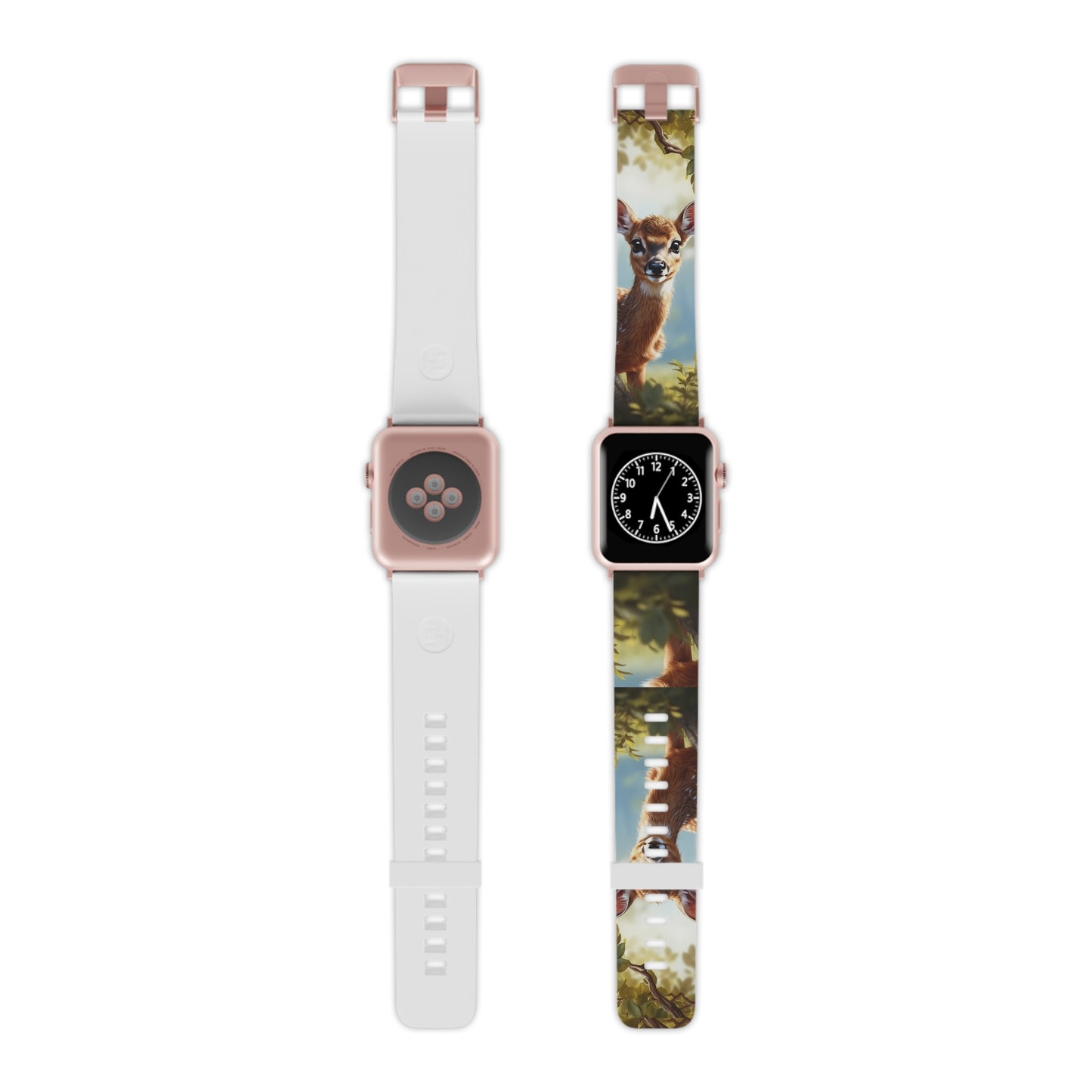 Whimsical Fawn in a Sunlit Forest Apple Watch Band