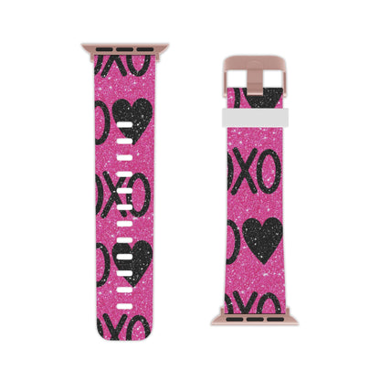 XOXO Glitter Hearts Apple Watch Band - BOGO Cases